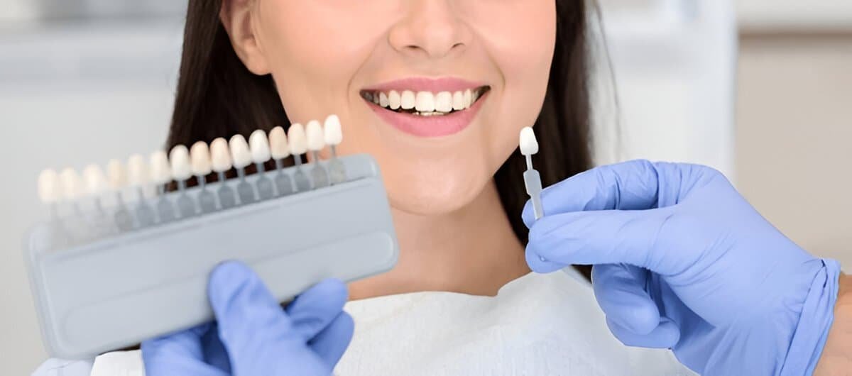 Woman receiving dental veneer consultation with a dentist holding shade guide.