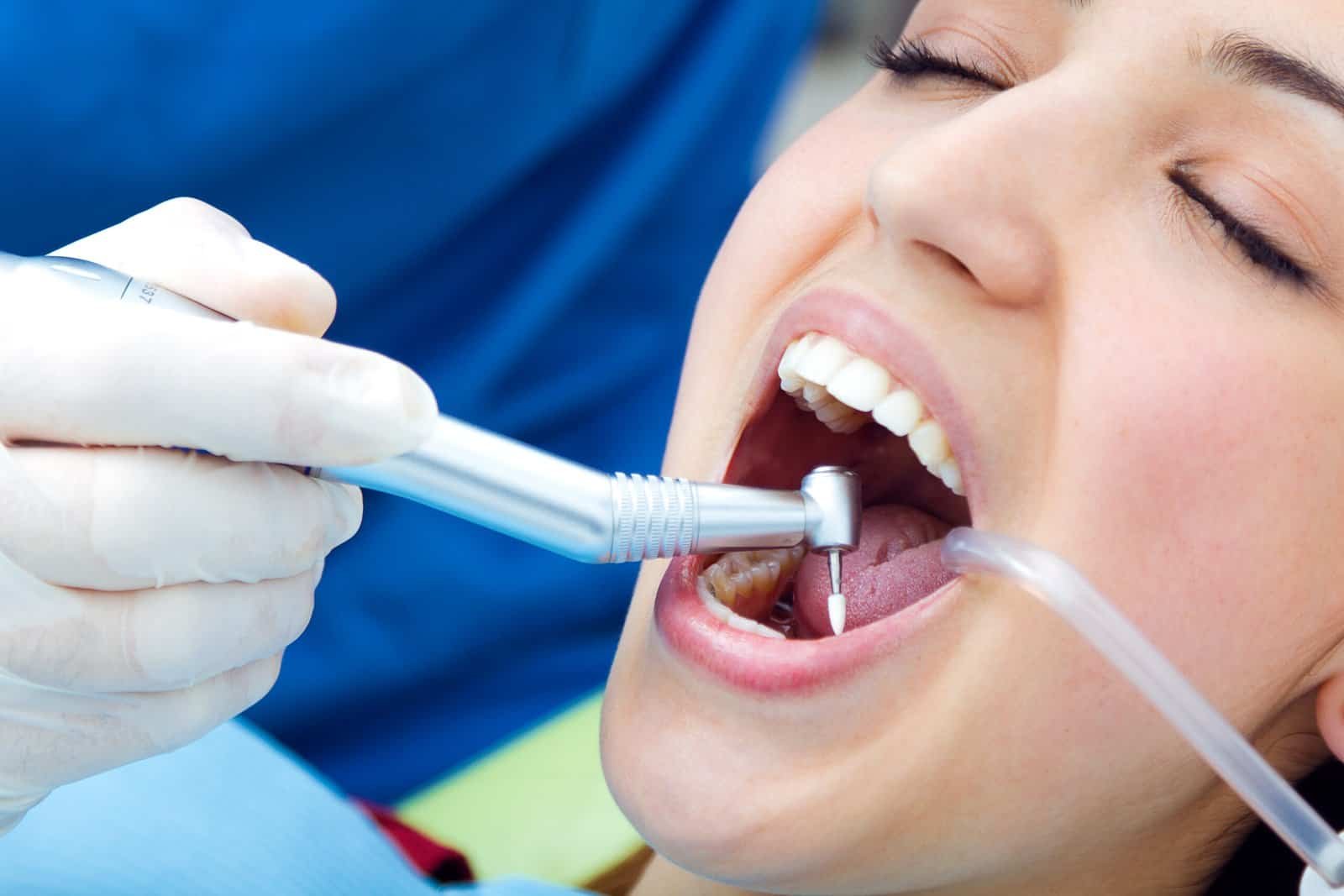 Dental Services at Sasha Aesthetic Clinic