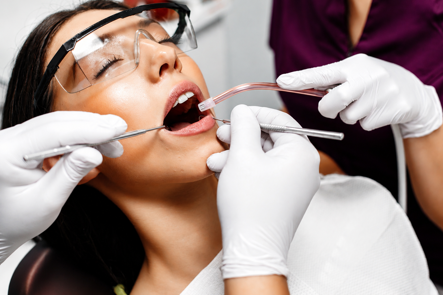 Step-by-step illustration of the scaling and polishing treatment process at Sasha Aesthetic Clinic