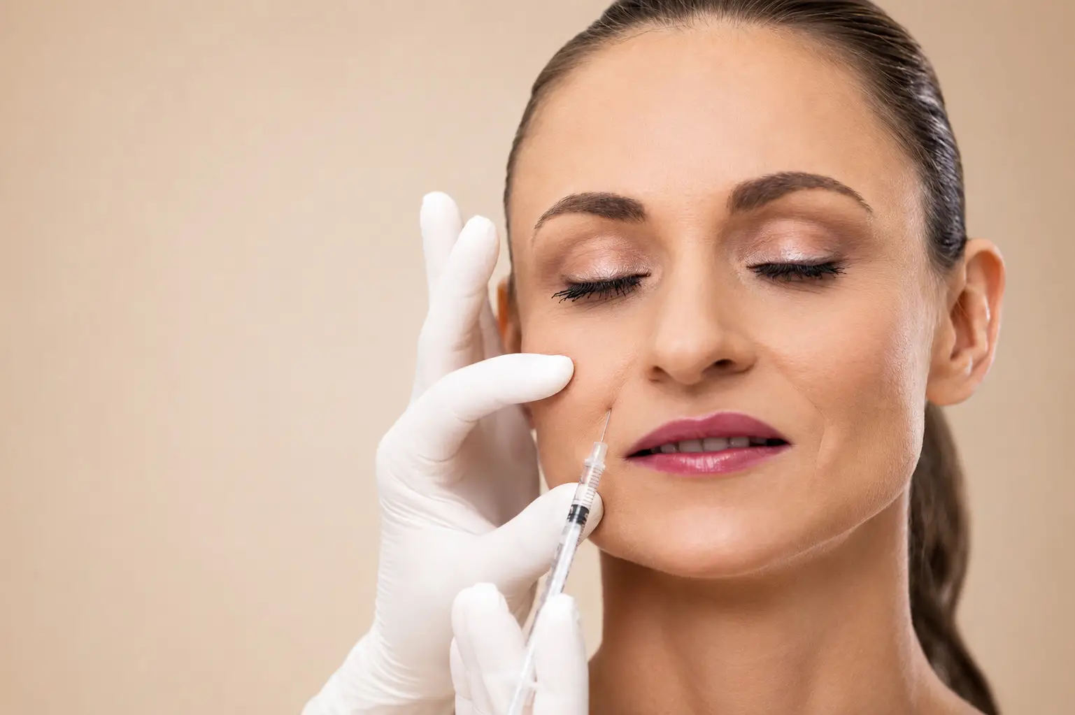 Face Fillers / Dermal Fillers 1 Dermal filler treatment at Sasha Aesthetic Clinic in JVC, Dubai