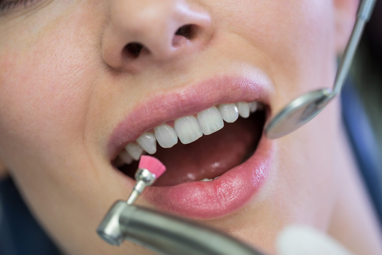 DHA-licensed dentist examining a patient during a scaling and polishing session at Sasha Aesthetic Clinic, JVC Dubai