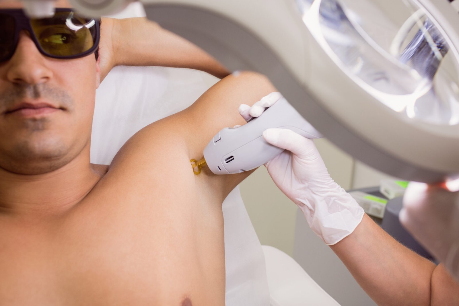 Laser hair removal for men process step at Sasha JVC Dubai