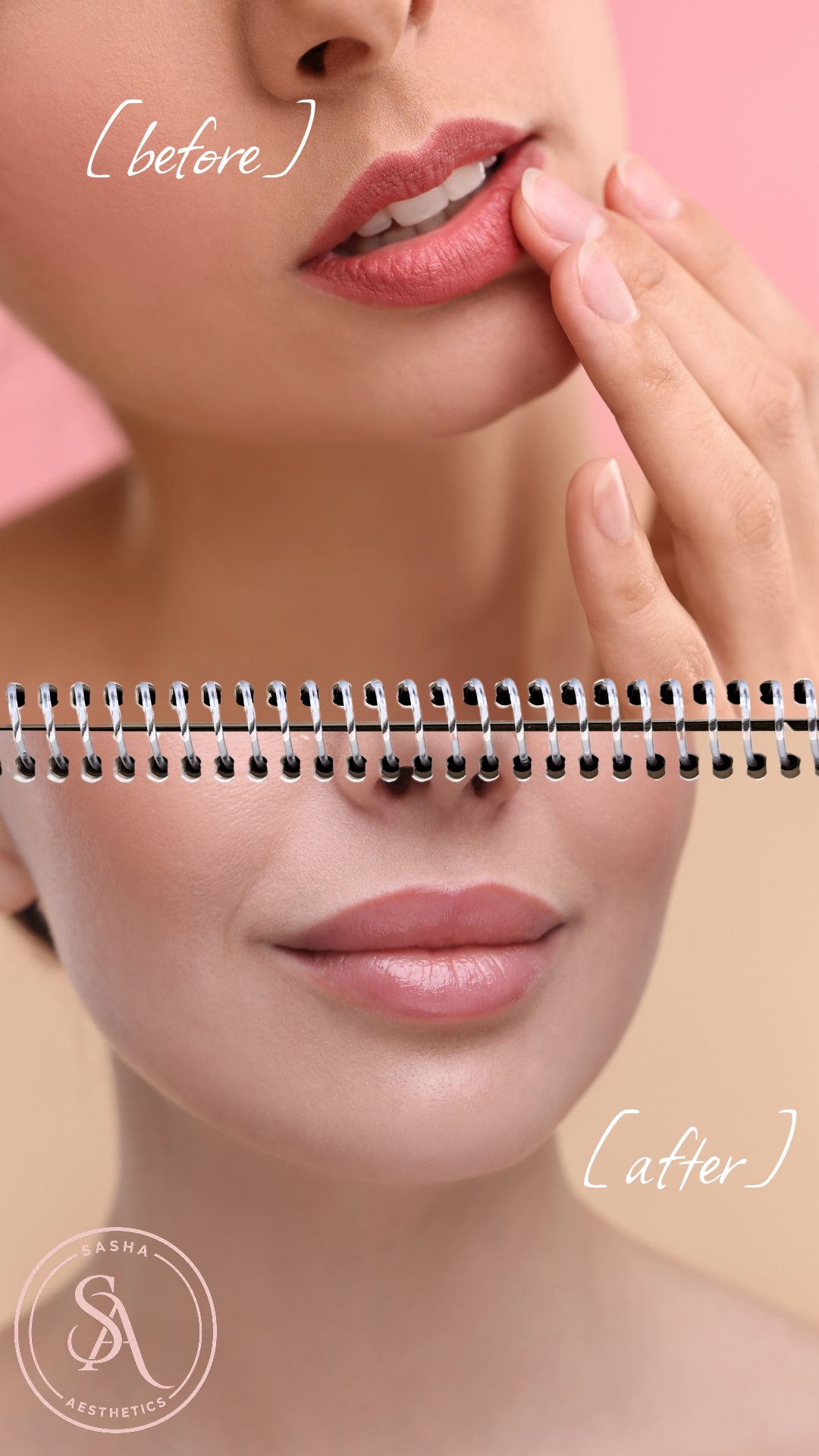 Patient planning a lip enhancement treatment in Jumeirah Village Circle